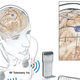 Una ilustración de la tecnología de estimulación cerebral profunda inalámbrica del equipo